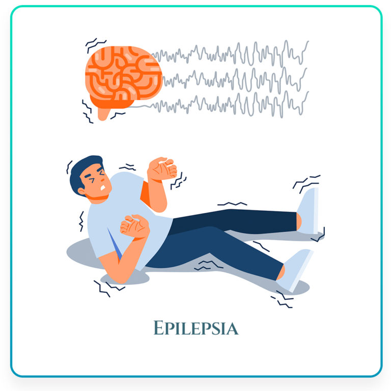 epilepsia